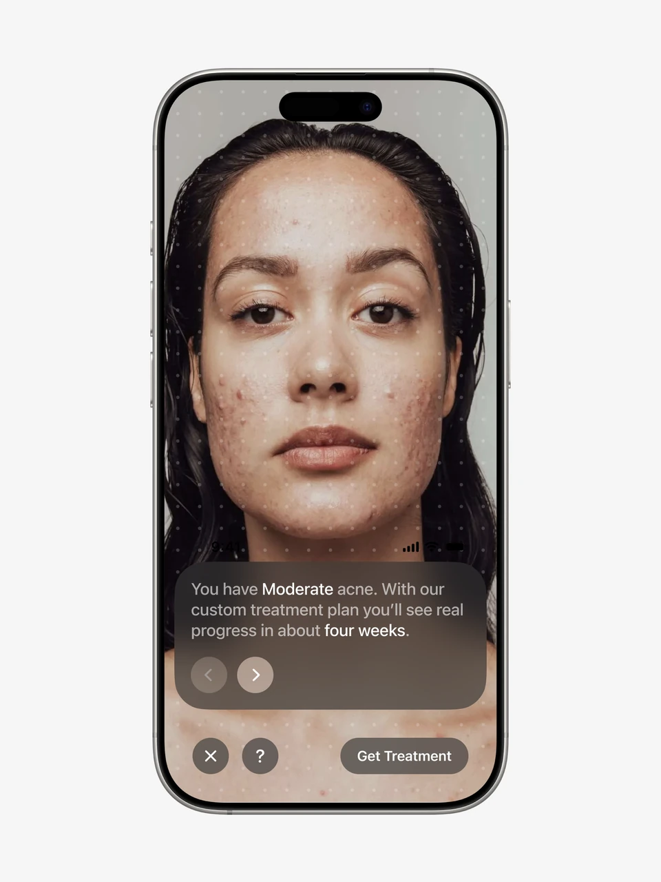 Nolla mobile skin assessment and treatment screen